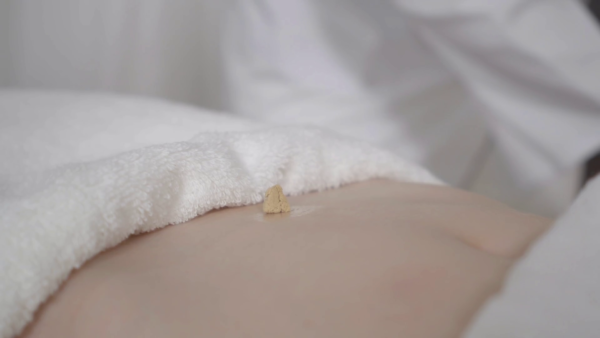 Moxabustão na ginecologia