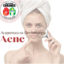 acupuntura na acne