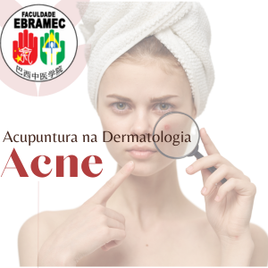 acupuntura na acne