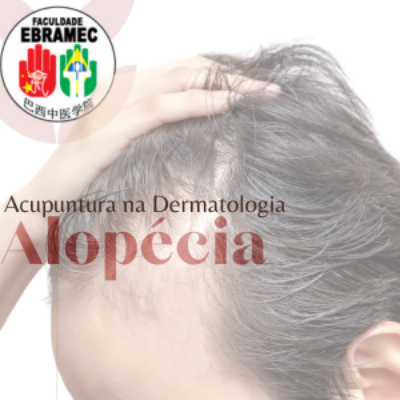 Acupuntura Alopecia