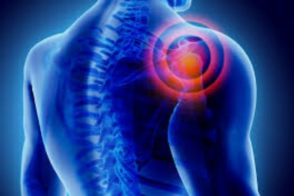 diferenciação de canais e dor no ombro