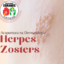 acupuntura na herpes zosters