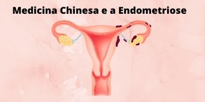 medicina chinesa e a endometriose
