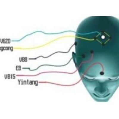 Neurologia e a Acupuntura