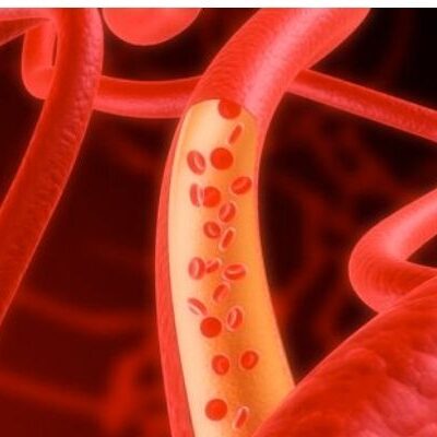 Pontos Especiais Doenças Vasculares