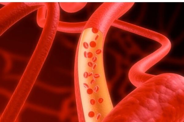pontos especiais e doenças vasculares