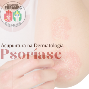 acupuntura na psoriase